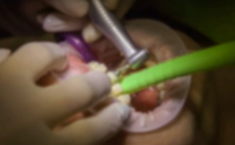 拔牙的作文300字(精品4篇)