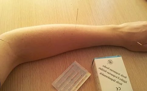 针灸推拿学专业学什么