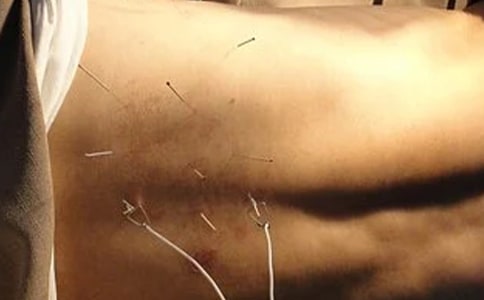 针灸实习心得体会