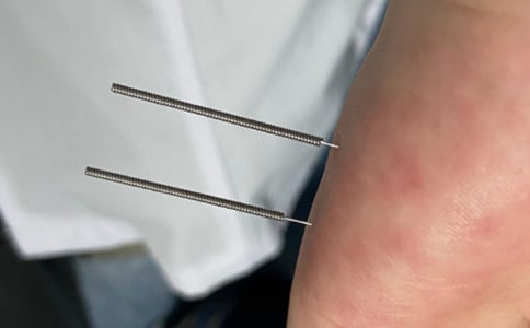 山东针灸专升本考什么